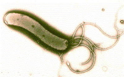 Helicobacter pylori Infection and
its Potential Role in Childhood
Eczema