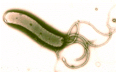 Helicobacter pylori Infection and
its Potential Role in Childhood
Eczema