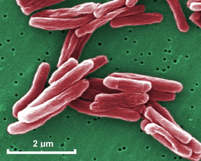 Rv3881c from Mycobacterium tuberculosis Elicits PolyFunctional CD8+  T cells in PPD Positive Healthy Volunteers and Affords Significant Protection in the Guinea Pig Model