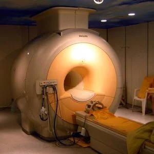 Fetal MRI in Early Diagnosis of Rare Disease in Brain