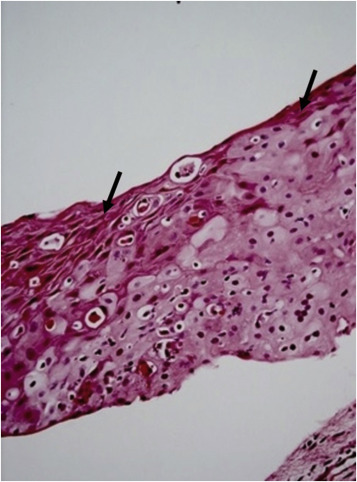 Concerning male urethritis and associated diseases, the 2017 Clinical Management of Infectious Disease Guidelines