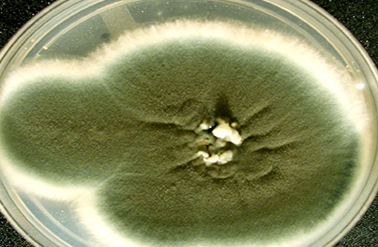 Identification of Unique Volatile Compounds of Aspergillus fumigatus for Potential Diagnostic Breath Test by HS-SPME and GC-MS