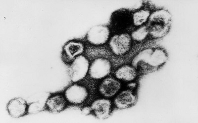 Seroprevalence of Natural Rubella Antibodies among Antenatal Attendees at Moi Teaching and Referral Hospital, Eldoret, Kenya