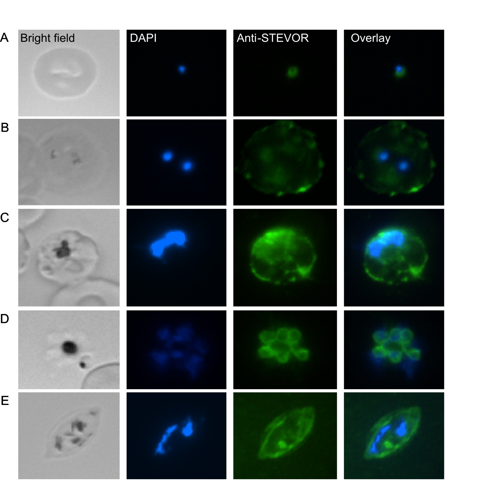 Standardization of a Multiplex
Magnetic Bead-based for
Simultaneous Detection of IgG to
Plasmodium Antigens