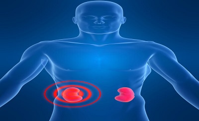 Plasma Neutrophil Gelatinase-
Associated Lipocalin (NGAL) in
Combination with Procalcitonin
(PCT) and MR-Proadrenomedullin
(MR-proADM) in the Diagnosis
and Prognosis of Sepsis and Sepsis
Associated Acute Kidney Injury