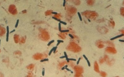 Immunochromatographic Assay
for Detection of Mycobacterium
Tuberculosis Complex in Clinical
Isolates at Instituto de Infectologia
Emilio Ribas, Brazil