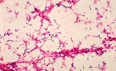 Status of Pneumococcal Pneumonia in a Public Hospital over a Period of 12 Years