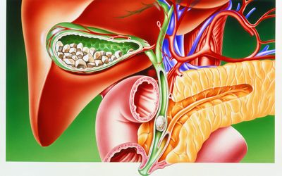 Diagnostic Imaging of Patients with Pancreato-Biliary Diseases: Comparison between Ultrasound, Computed Tomography and Magnetic Resonance