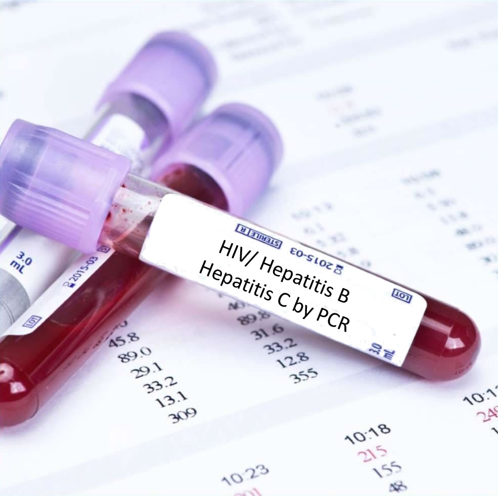 Outcome of Therapy in HCV Patients in a Public Health Tertiary Care Center