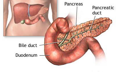 Imagiology of Caroli’s Disease