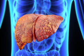 Young Research Forum – Young Scientist Awards: Liver Diseases 2020, Singapore, December 07-08, 2020