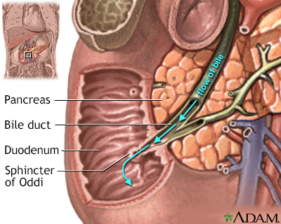 Complication of Bile Duct on Hepatic Post Transplantation