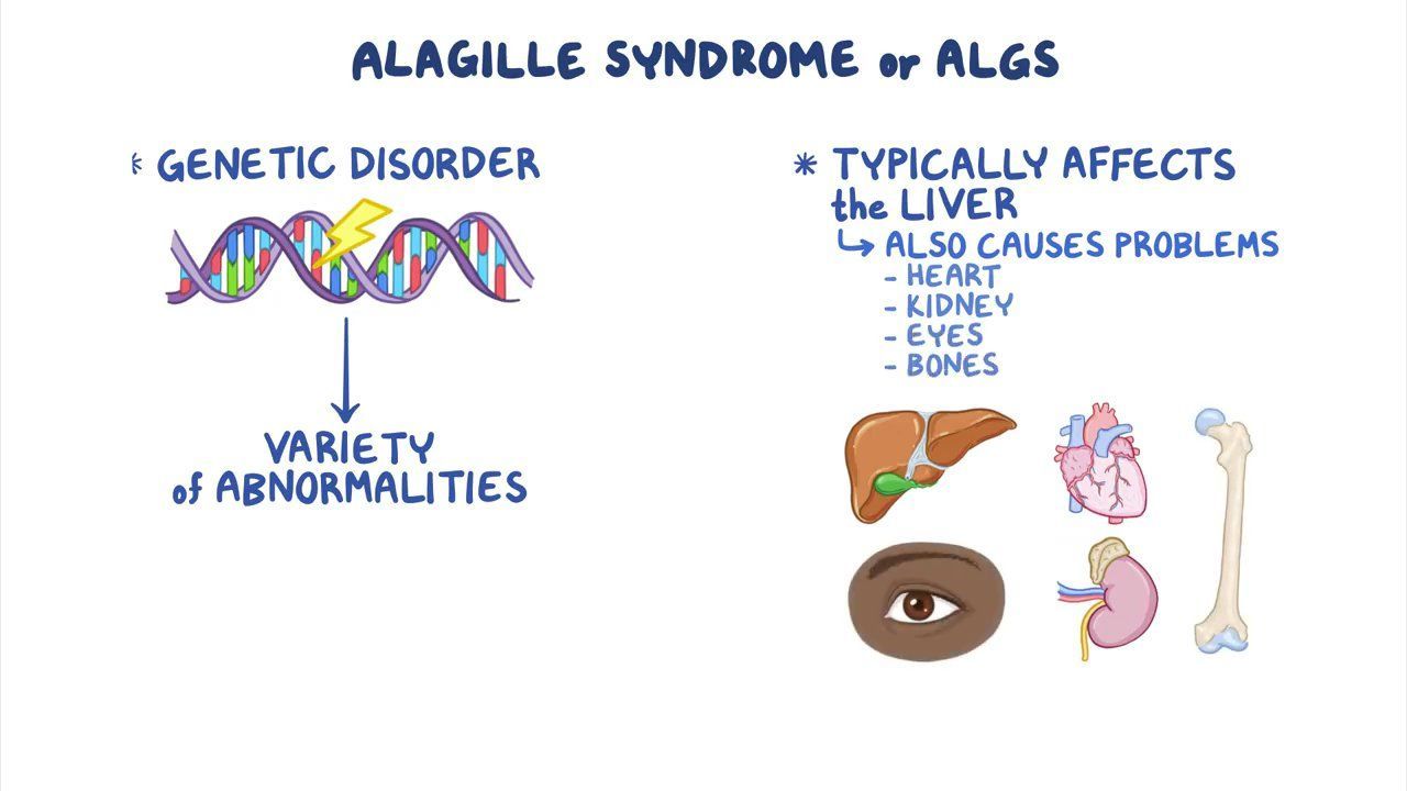 Allagile Syndrome