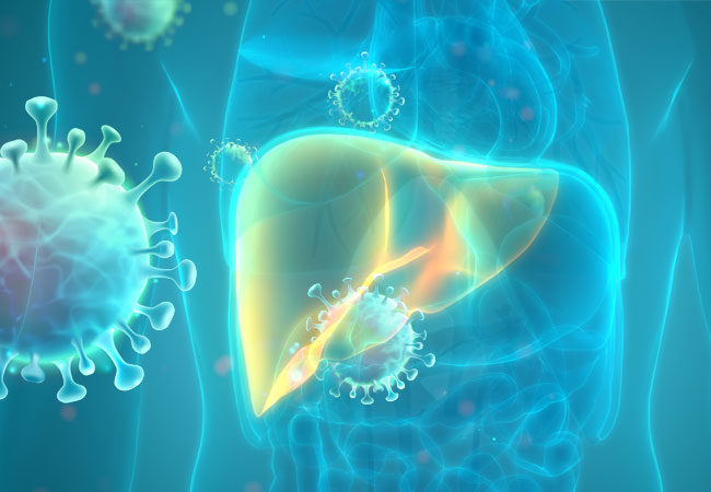 Covid-19 with liver disease