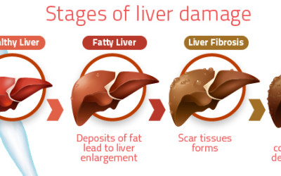 Unpredictable Effects of Chemical Mixtures on Liver in Health and Disease