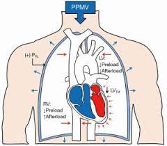 Hemodynamic and Cardio-Respiratory Compromise