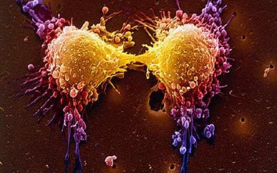 Sorafenib and Mammalian Target of Rapamycin Inhibitors after Liver Transplantation: A Single-Center Experience and Review of the Literature