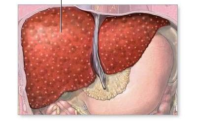 Predictors of Pulmonary Hypertension among Hospitalized Patients with Cirrhosis