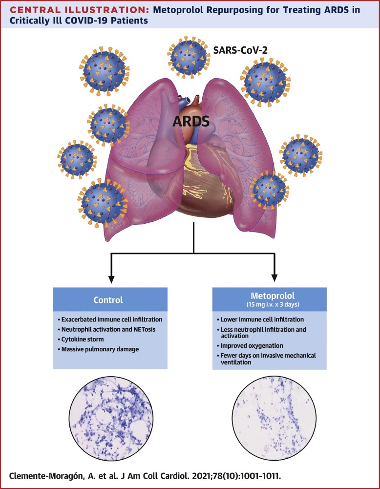 A Pilot Study to Improve Outcomes of Poor Prognosis in Coronavirus Patients