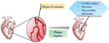 Process and Delivery System of Myocardial Dead Tissue in Human Blood Stream