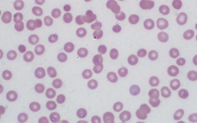 Antileishmanial Potential of Chondrococcus hornemanni against Experimental Visceral Leishmaniasis