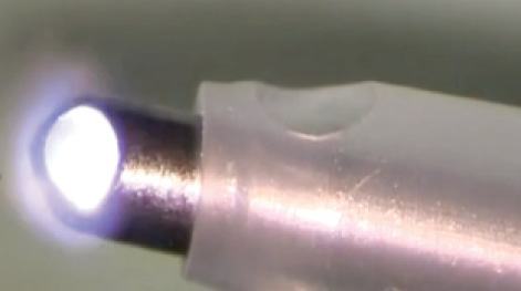Strain in Vanadium Thin Film due Nanosecond Laser Treatment
