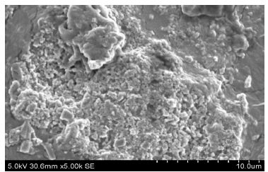 Synthesis, Characterization and In Vitro Assessment of Gellan Gum Tamoxifen Citrate Macrobeads and Nanoparticles