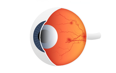 Neuroprotective Effect of Photoactive Quantum Dots in Progressive Retinal Photoreceptor Degeneration