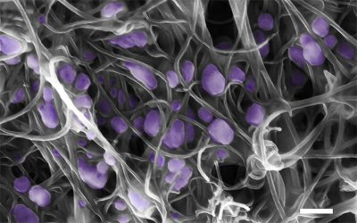 A Novel Biosensor for Detection of Salmonella typhimurium Carrying SSeC Gene Based on the Secondary Quenching Effect of Carbon Nanotubes