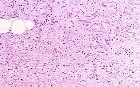 Fibroblast Behavior on PMMAEA and PMMAEA-Collagen Films and Nanofibers