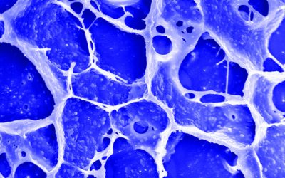 Novel Synthesis and Magnetic Properties of PVP Capped Cobalt Nanostructures