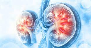 Chronic kidney disease