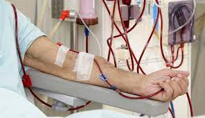Effect of Frequent Hemodialysis on Residual Kidney Function