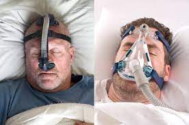 Chronic Kidney Disease in Patients with Obstructive Sleep Apnea