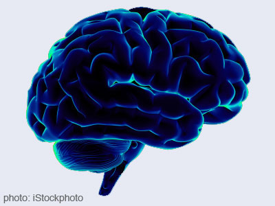 Affects Alzheimer's disease in brain functioning