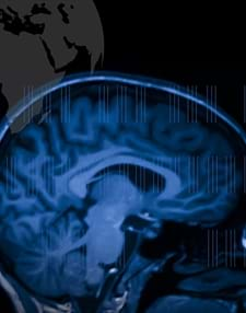 Stroke: Mechanisms in Search of Treatments