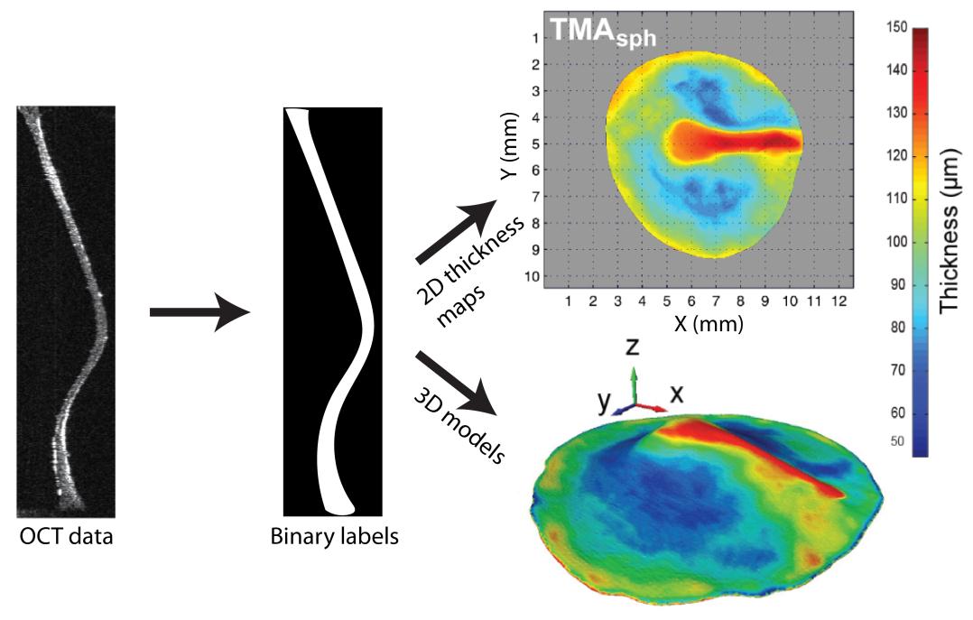 Recent Developments in FullField Thickness Measurements of the Human Eardrum