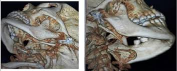 Highlights of the Otorhinolaryngology