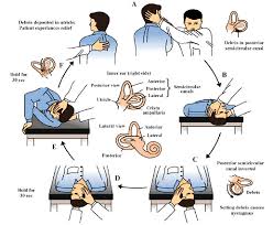 Disability in Protracted Benign Paroxysmal Positional Vertigo at One Month from Symptom Onset- a Questionnaire Survey