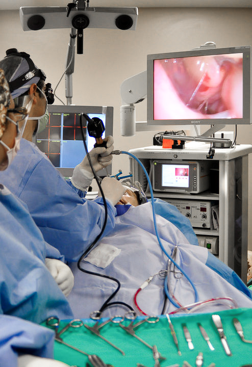 Outpatient Treatment of Post Functional Endoscopic Sinus Surgery Adhesions: How we do it?