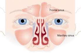 Sinusitis Disease in People and its Circumstances