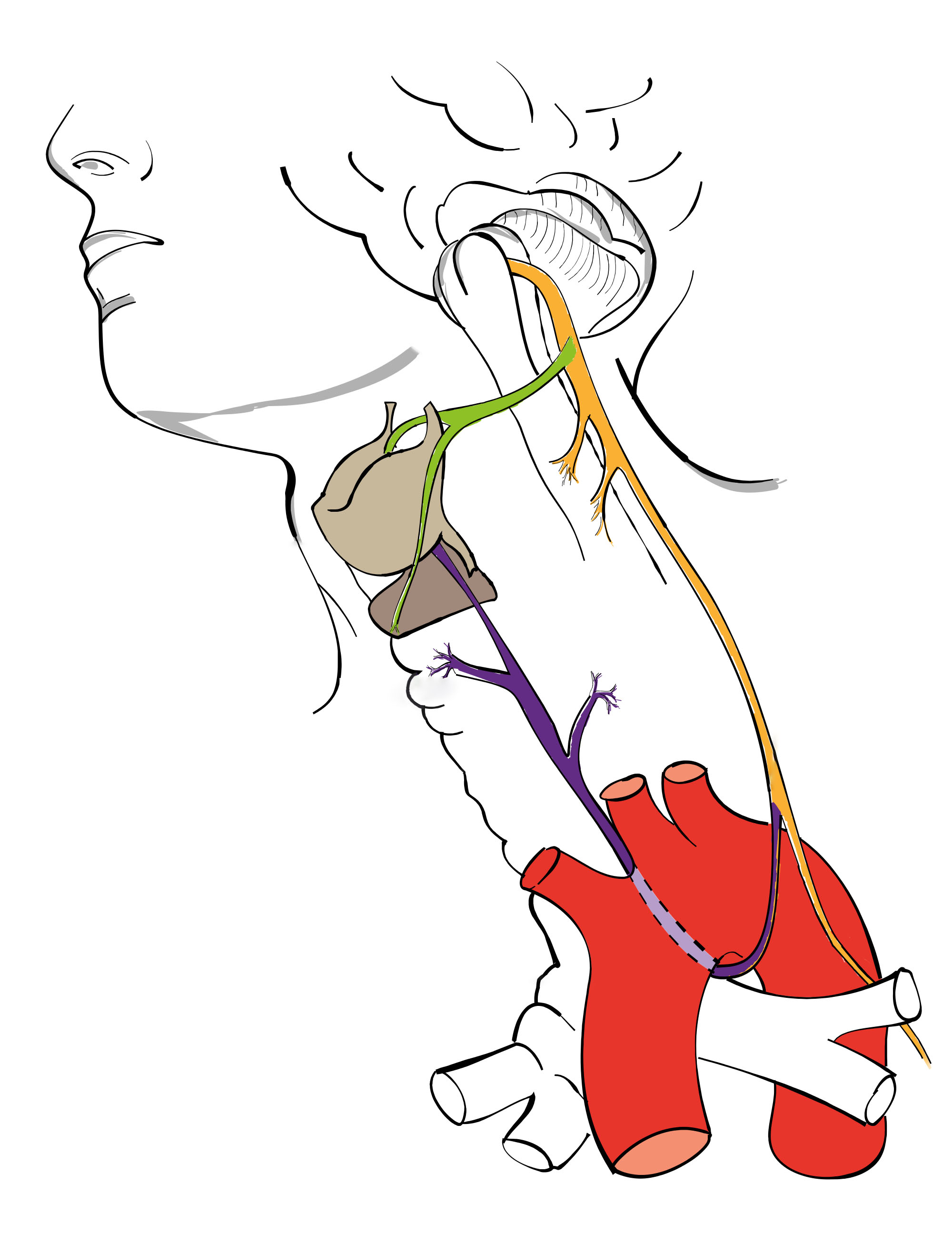 Cases and Medico-Legal Aspects Regarding Bilateral Iatrogenic Injury of the Recurrent Laryngeal Nerve