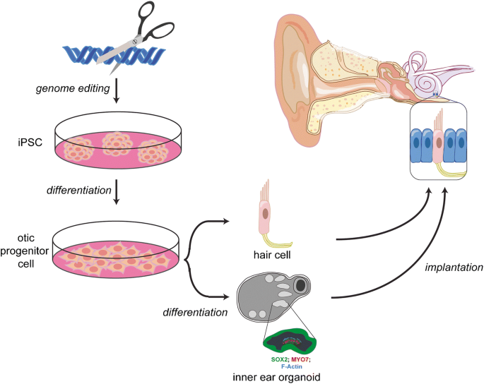 A Stem Cell-Based Replacement for the Inner Ear
