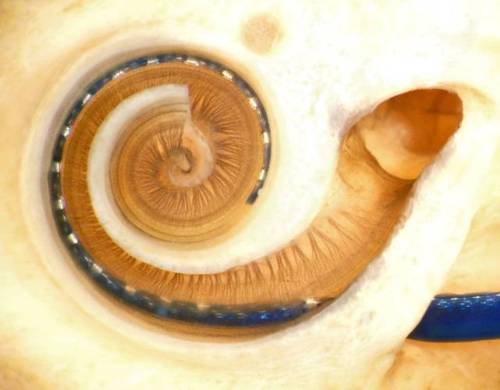 Review of Opioid-Associated Hearing Loss and Possible Mechanism of Opioid-Mediated Endothelin-1-Dependent Cochlear Vasoconstriction