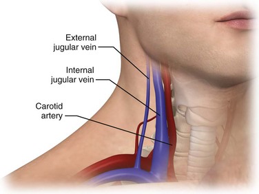 Flow Evaluation of the Internal Jugular Vein after Neck Dissection