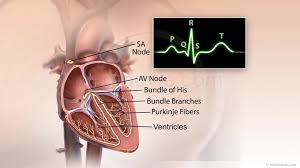 Spatial Distribution of Conduction Disorders during Sinus Rhythm