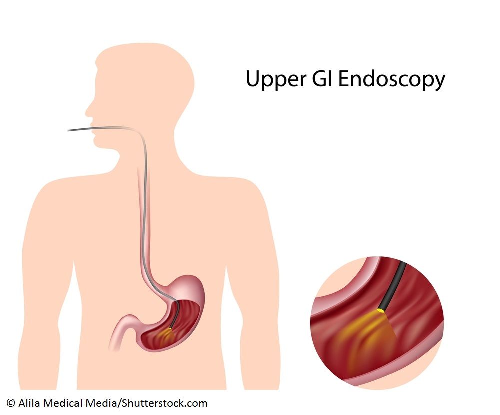 Endoscopic Management of Congenital Cholesteatoma