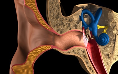 Foreign Body in Middle Ear: Our Experience