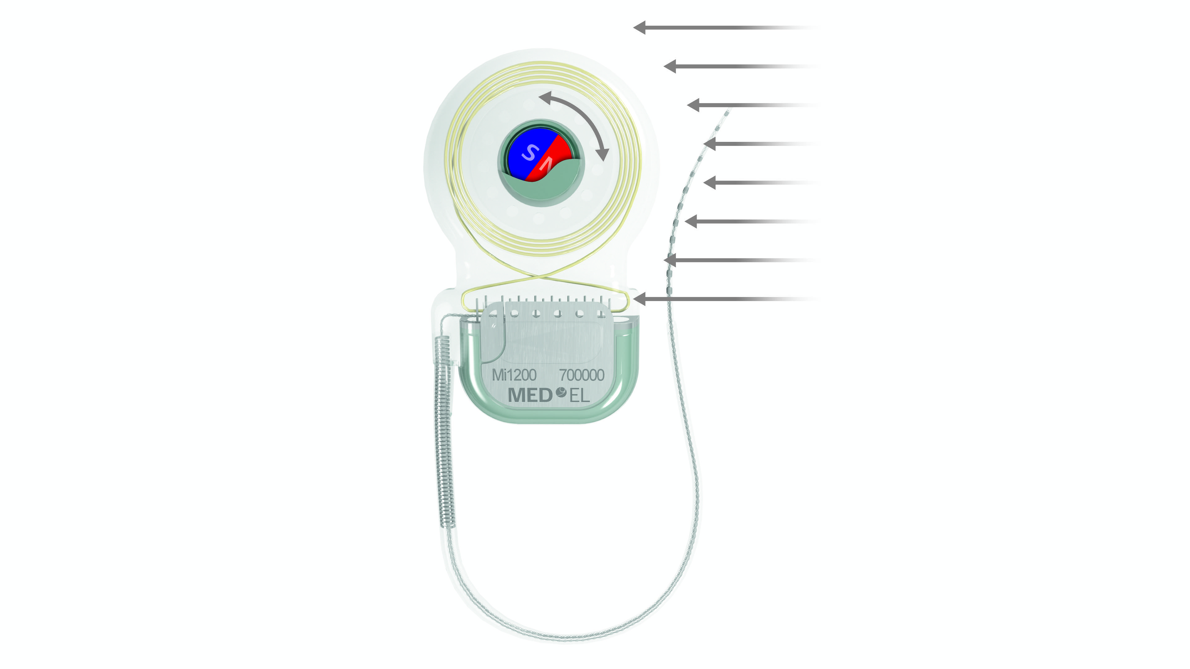 MRI Safety with Cochlear Implants up to Three Tesla – Experiences by Performing an In Vitro Test