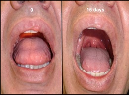 Multidisciplinary Approach to the Patient with Obstructive Sleep Apnea